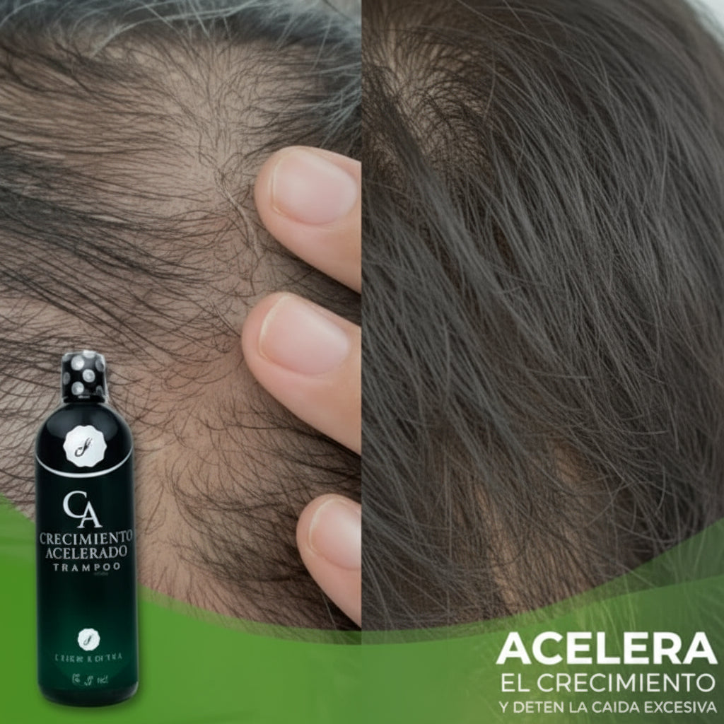 🥇 OFERTA ÚNICA 2x1: [3 Productos!] Tónico Crecimiento Acelerado + Mascarilla Karsell de REGALO